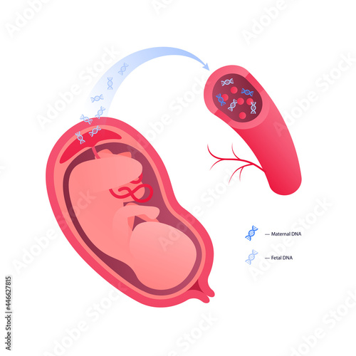 Noninvasive parental testing NIPT concept. Vector flat healthcare illustration. Genetic test. Embryo in womb, blood vessel, dna spiral symbol. Design for healthcare, pharmacy, family planning