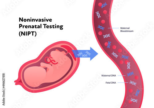 Noninvasive parental testing NIPT concept. Vector flat healthcare illustration. Genetic test. Baby in womb, blood vessel, dna spiral symbol. Design for healthcare, pharmacy, family planning
