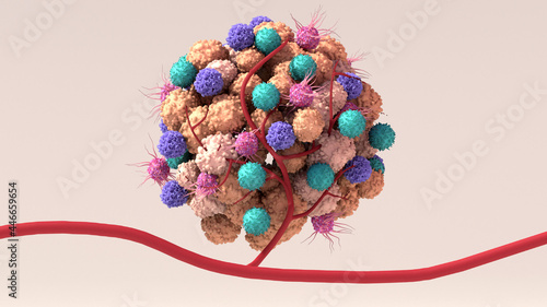 Tumor microenvironment, normal cells, molecules, and blood vessels that surround and feed a tumor cell. Microenvironment can affect how a tumor grows and spreads. photo