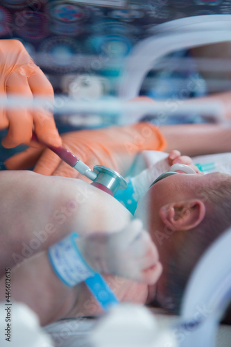 Obraz na plátně Noworodek w inkubatorze na oddziale neonatologii