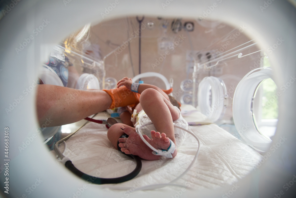 Noworodek w inkubatorze na oddziale neonatologii. Intensywna terapia.  - obrazy, fototapety, plakaty 