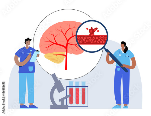 Brain stroke hemorrhagic