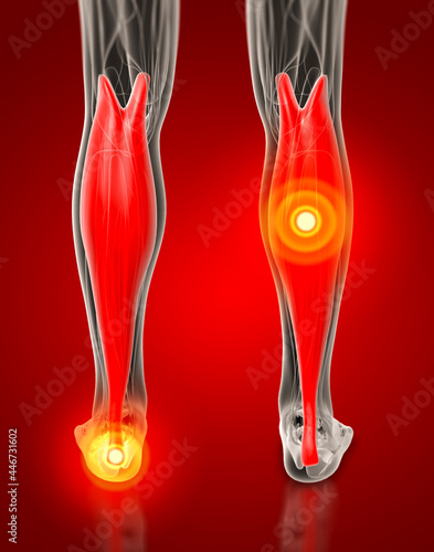 3d rendering medical  illustration of the gastrocnemius