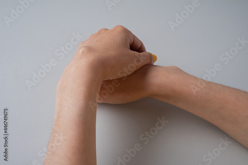 Ganglion cyst on woman hand on white background photo