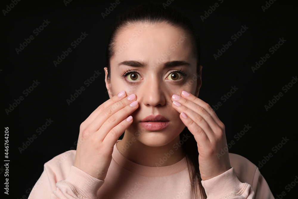 Woman checking her health condition on black background. Yellow eyes as symptom of problems with liver Woman checking her health condition on black background. Yellow eyes as symptom of problems with liver