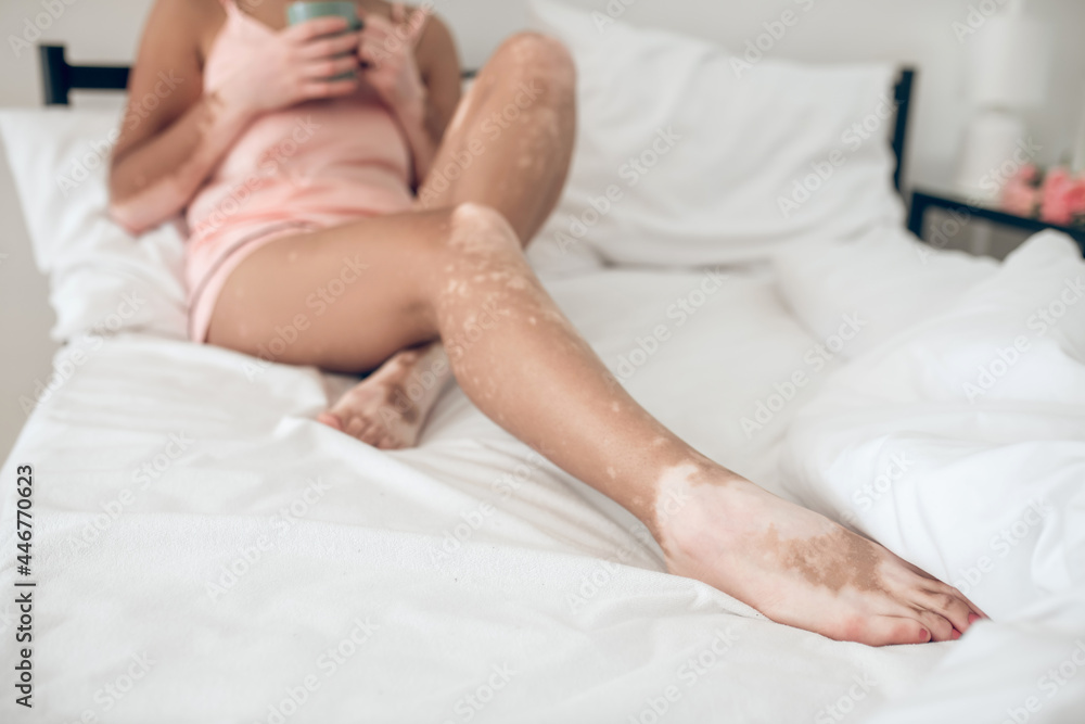Dark-skinned woman with skin pigmentation lying in bed Dark-skinned woman with skin pigmentation lying in bed
