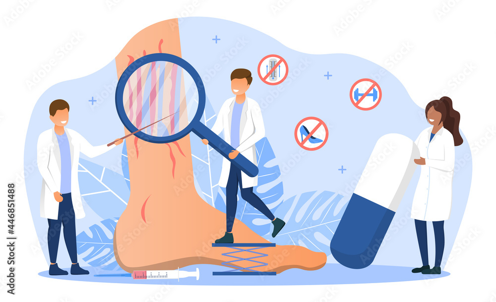 Varicose veins concept. Doctors check the vessels of the legs with the help  of special tools. Treatment of vascular diseases. Cartoon modern flat  vector illustration isolated on a white background Stock Vector |