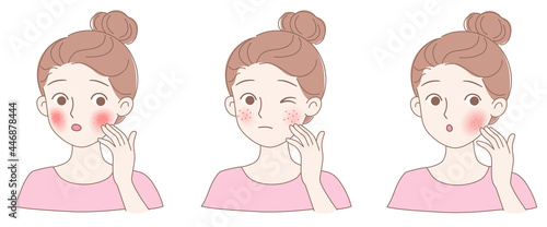 Three types of facial skin problems, allergic skin itching, acne and dry skin