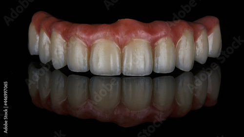 composition of dental prosthesis of the upper jaw on black glass with creative reflection