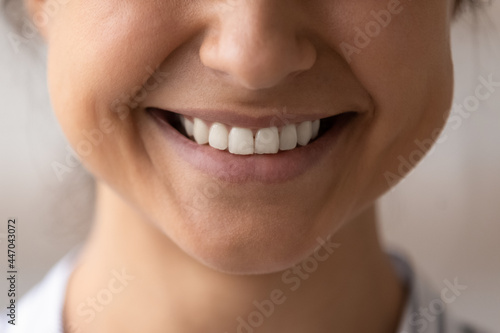 Close up cropped Indian woman healthy toothy beaming smile, young female with straight white teeth, satisfied client customer excited by dental whitening service, oral hygiene and treatment concept