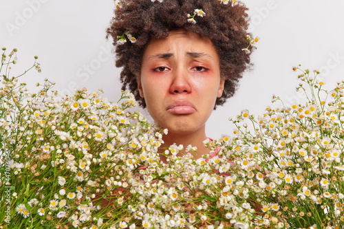 Close up shot of frustrated curly haired Afro American woman surrounded by camomile flowers has red swollen eye srunny nose suffers from seasonal pollen allergy needs consultancy of immunologist photo