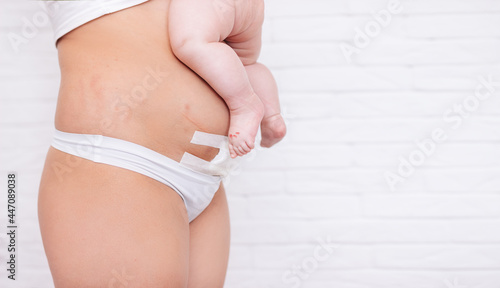Foto Slim and fit figure after cesarean section