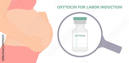 Labor swept drug baby Foley Strip sweep sac uterus hook Amnio fetus risk Cook ripe IV line bulb speed up plug mucus previa water vagina ripen first gland loop birth give method induce cervix sweeping