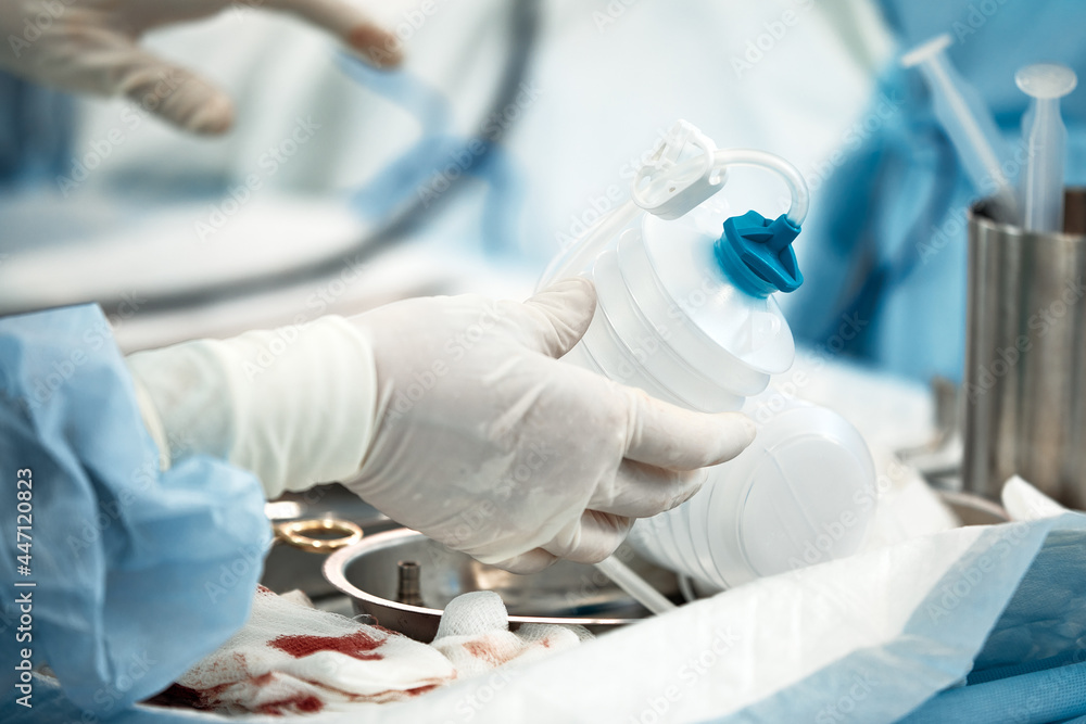 The surgeon's hands are installing an expander for the correction of the mammary gland after the removal of a cancerous tumor, a close-up of the doctor's hands with gloves preparing for the The surgeon's hands are installing an expander for the correction of the mammary gland after the removal of a cancerous tumor, a close-up of the doctor's hands with gloves preparing for the