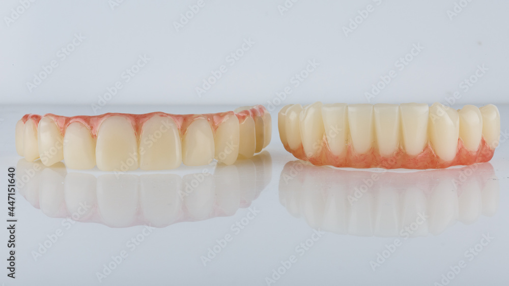 Two temporary dental prosthesis of polymer and pink gum top and lower jaws on a white background Two temporary dental prosthesis of polymer and pink gum top and lower jaws on a white background