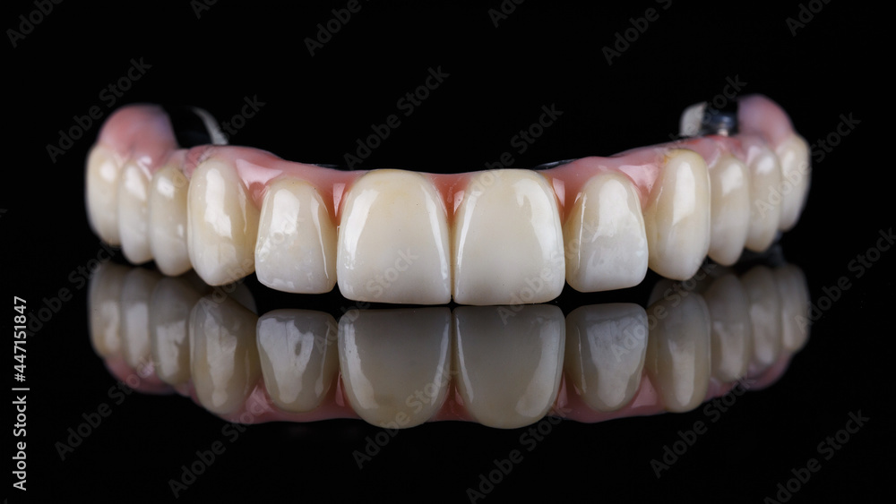 Dental Upper Jaw Prosthet on Black Glass With Reflection Dental Upper Jaw Prosthet on Black Glass With Reflection