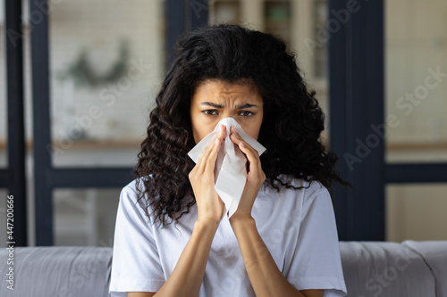 Cold and flu concept. Young african american woman with cold, sneezing and using napkin