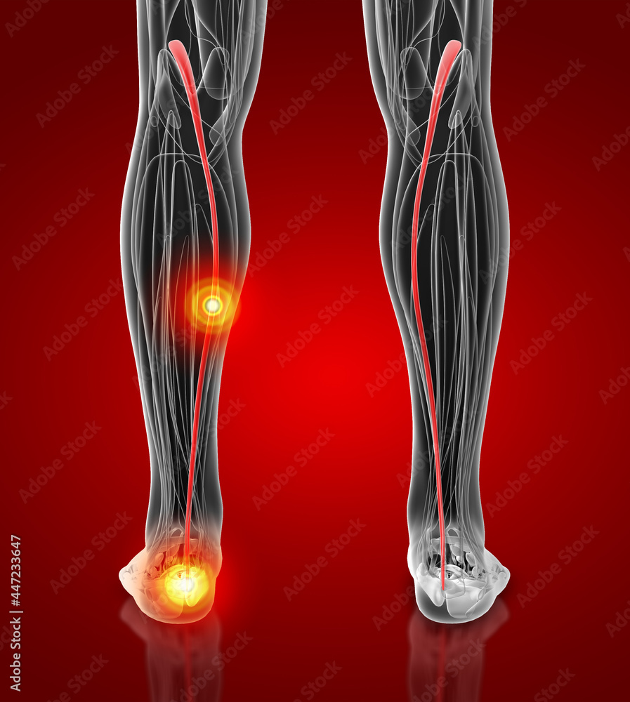 3d rendering medical illustration of the plantaris 3d rendering medical illustration of the plantaris