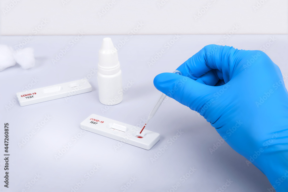 Doctor Making A Rapid Test Kit For Viral Disease COVID 19 NCoV 