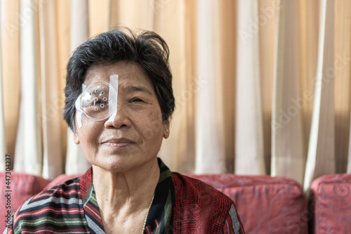 Cataract elderly patient, Asian old senior woman having eye care treatment on Age-related eye diseases, AMD, Diabetic retinopathy, retinal disorders problem, Retinal detachment, Glaucoma or low vision photo