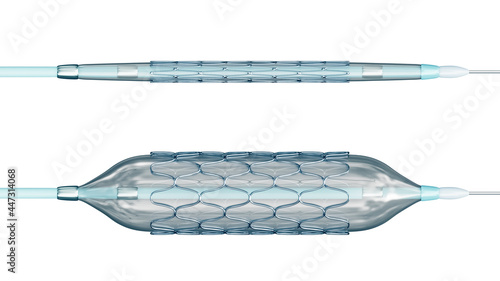 Deployed and collapsed stent ready for angioplasty isolated on white background 3D rendering illustration. Medical, surgery, cardiology, medicine, science, technology, healthcare concept. photo