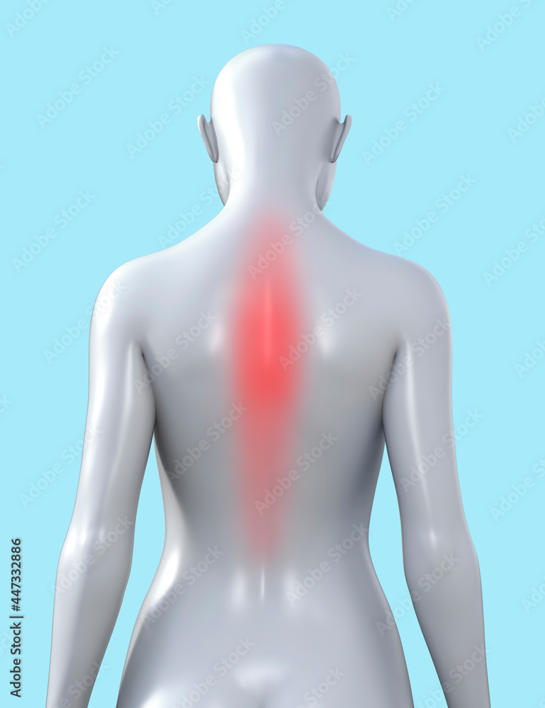 3d render illustration of female figure with red inflammated spine area on blue background, neuropathologist clinic concept. 3d render illustration of female figure with red inflammated spine area on blue background, neuropathologist clinic concept.