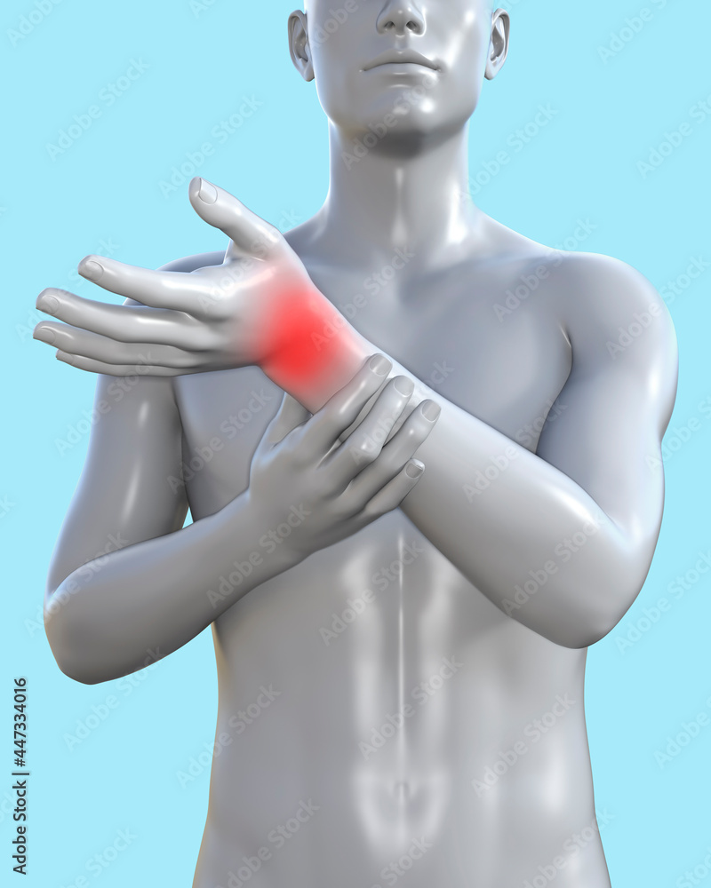 3d render illustration of male figure with red inflammated wrist area on blue background, traumatology clinic concept. 3d render illustration of male figure with red inflammated wrist area on blue background, traumatology clinic concept.