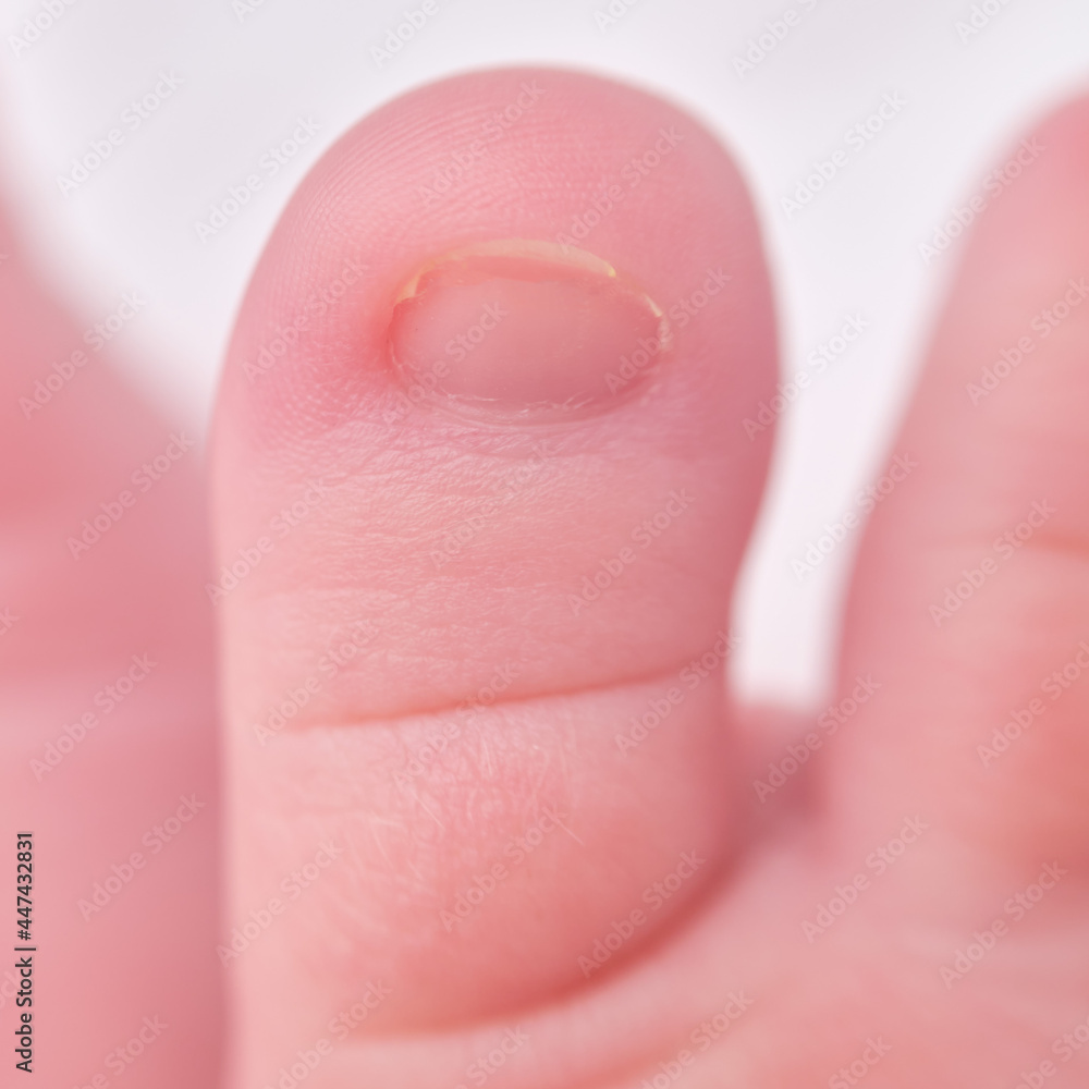 Toes on the foot of a newborn baby, close-up. Macro photo of a healthy toe of a child Toes on the foot of a newborn baby, close-up. Macro photo of a healthy toe of a child