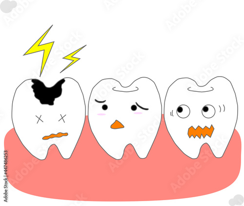 虫歯を心配する他の歯のイメージ