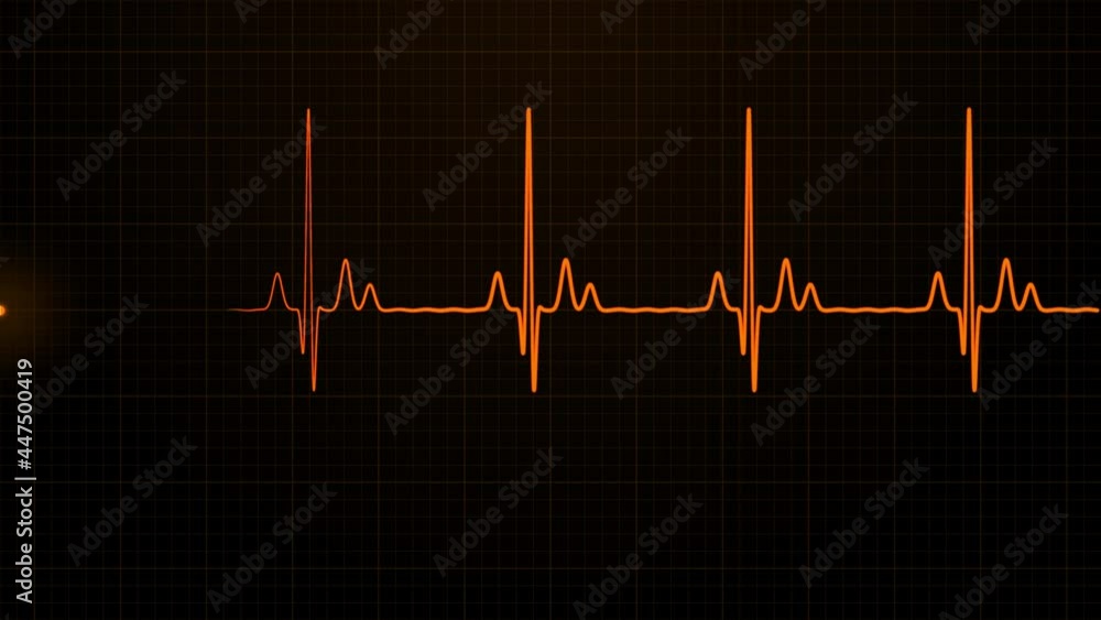 Loopable Orange ECG cardiogram oscilloscope monitor heartbeat line shows 60 BPM heart rate on