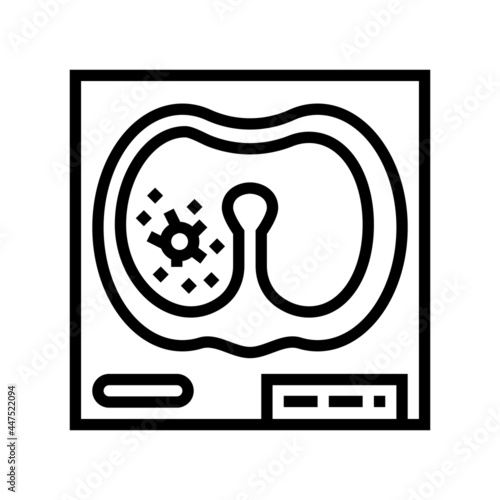 lung mucormycosis line icon vector. lung mucormycosis sign. isolated contour symbol black illustration