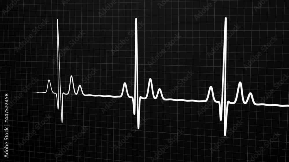 Loopable White 3D EKG/ECG cardiogram oscilloscope monitor heartbeat