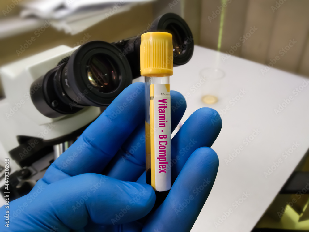 Biochemist or scientist hold blood sample for Vitamin B Complex test in laboratory. Diagnosis