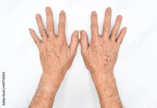 Canvas Print Age spots on hands of Asian elder man