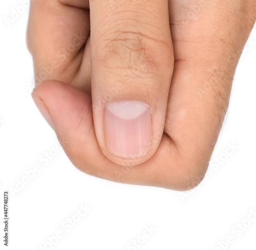 Vászonkép Large lunulae or half-moon at thumb fingernail with longitudinal lines of Southeast Asian, young man