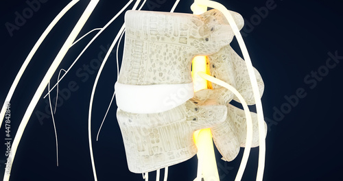 Protrusion of intervertebral discs, formation of a spinal hernia, anatomy of the spine, joint, vertebrae, Meningocele
