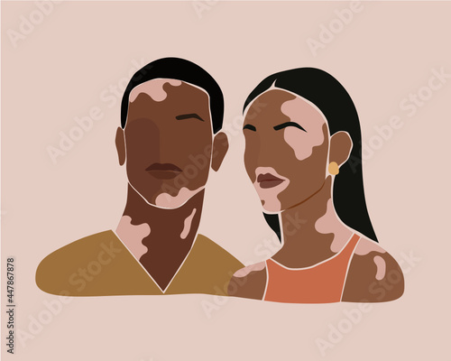 Two people with vitiligo of different nationalities. World vitiligo day concept photo