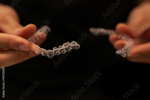 Orthodontist holds in his hands invisaling alienators, invisible orthodontic technique photo