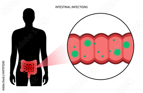 Intestinal infections disease