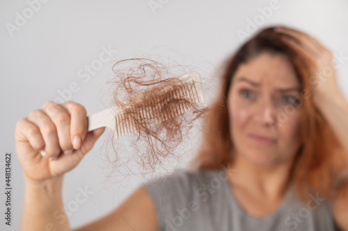 Caucasian woman with a grimace of horror holds a comb with a bun of hair. Hair loss and female alopecia.