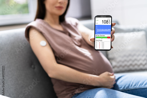 Continuous Glucose Monitor Blood Sugar Test