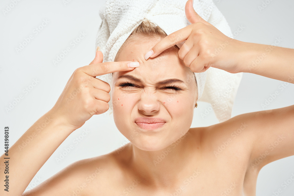 woman with bare shoulders with a towel on her head squeezes out pimples and dermatology hygiene woman with bare shoulders with a towel on her head squeezes out pimples and dermatology hygiene