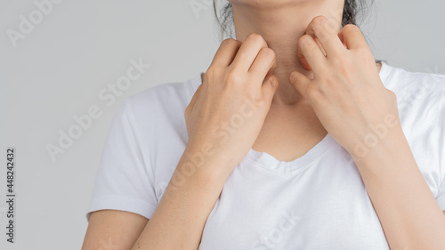 Woman scratching her neck due to itching, medical concept © ArLawKa