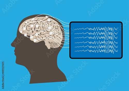 Concept of human brain and electroencephalography recording photo
