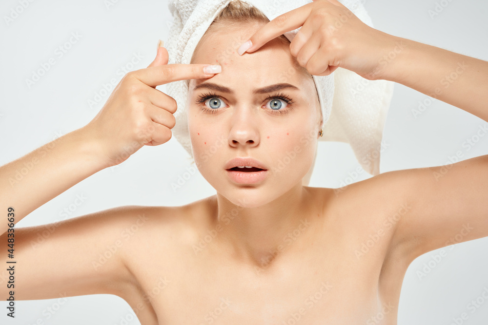 woman with bare shoulders with a towel on her head acne dermatology woman with bare shoulders with a towel on her head acne dermatology