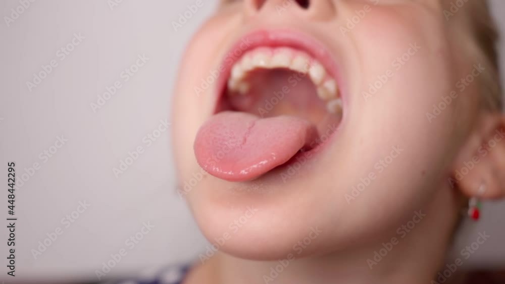 girl opens her mouth wide and pulls out long tongue. child shows his teeth and mouth to dentist. mouth is wide open, tongue is stuck out as far as possible, with clear view of tongue and soft palate ▶0:18 ▶0:18 
