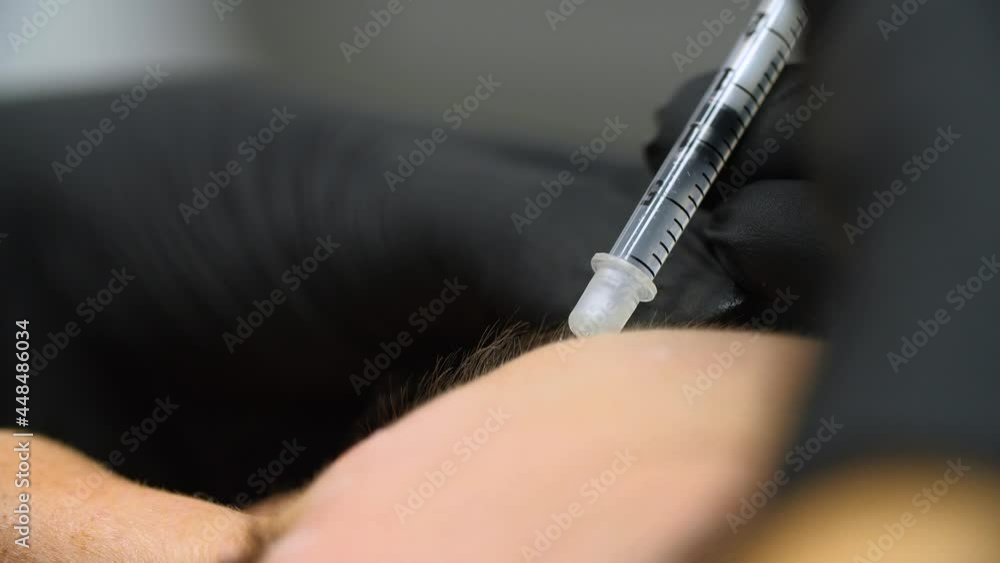 Botox injection by a beautician with a syringe into a woman's forehead. Close up. Botox injection by a beautician with a syringe into a woman's forehead. Close up.