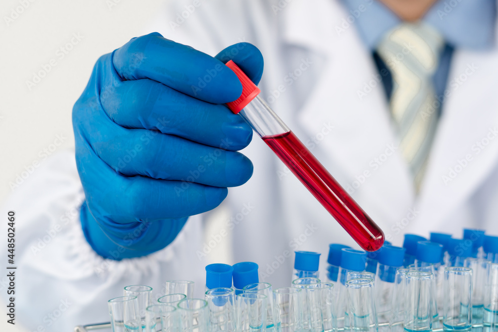 Lab worker preparing test blood for detection of antibodies and infections virus. Lab worker preparing test blood for detection of antibodies and infections virus.