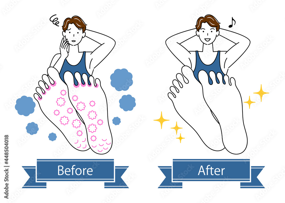 スキンケア 水虫 足裏のお肌トラブルのビフォーアフター 可愛い男性のイラスト シンプル ベクター スキンケア 水虫 足裏のお肌トラブルのビフォーアフター 可愛い男性のイラスト シンプル ベクター