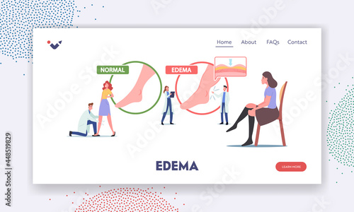 Edema Disease Landing Page Template. Tiny Doctor and Patient Characters at Huge Infographics Presenting Diseased Legs